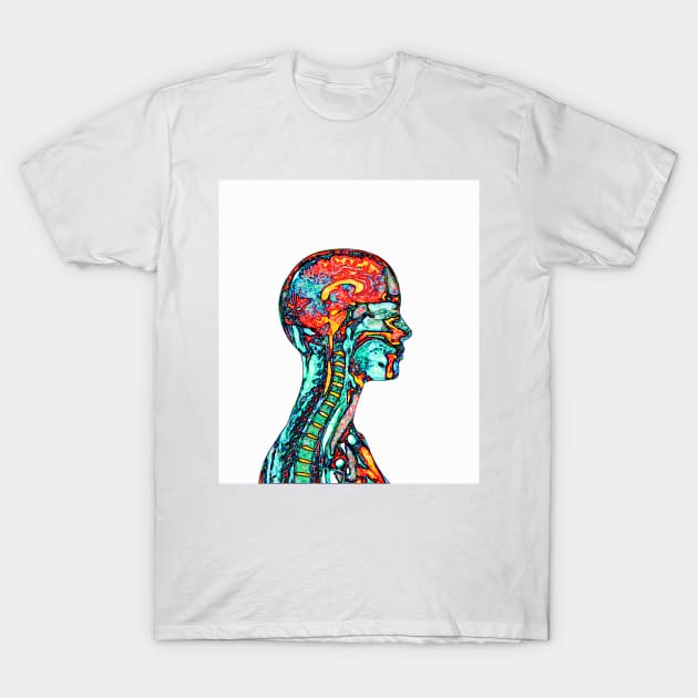 Brain and spinal cord, MRI (P320/0043) T-Shirt by SciencePhoto
